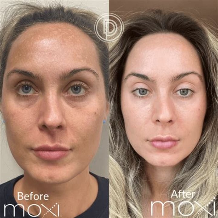 All You Need to Know About Konig Face: The Revolutionary Approach to Skincare