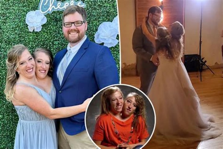 Brittany and Abby Hensel Wedding: A Unique Celebration of Love and Unity