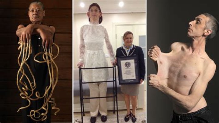 The Skinniest People in the World: Stories, Science, and Surprises