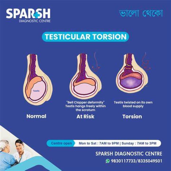 Understanding Testicular Torsion: The Meme Phenomenon