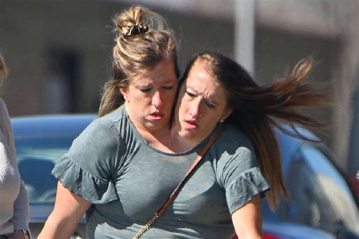 Understanding the Life and Legacy of Abby and Brittany Hensel: What is the Cause of Death?