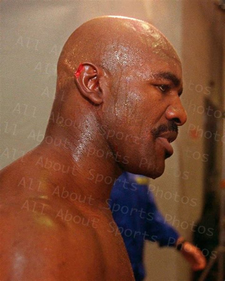 Unraveling the Legend of Mike Tyson Bites: The Infamous Ear Incident