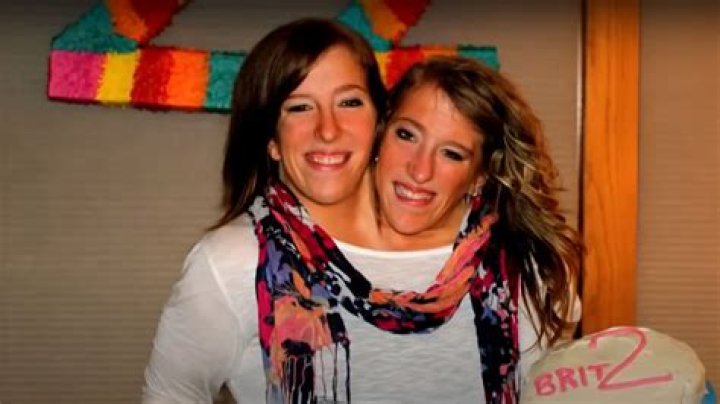 Unraveling the Lives of Conjoined Twins Abby and Brittany