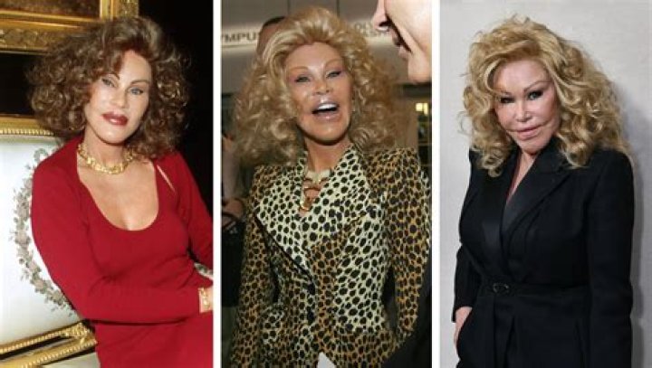 Unveiling the Intriguing Life of Jocelyn Wildenstein Before Surgery